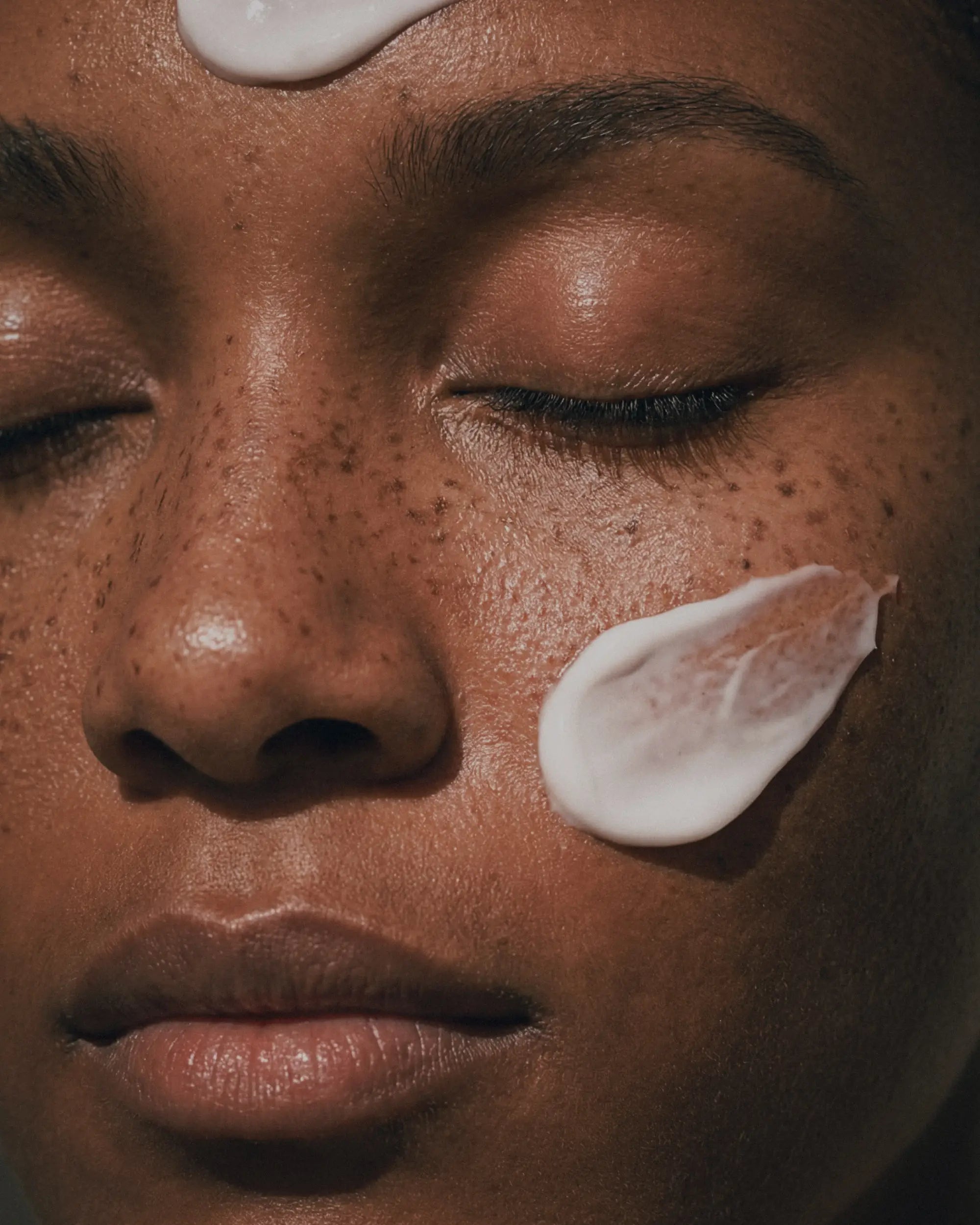 Cosmelan depigmentation peel treatment at CQ Aesthetics Rockhampton