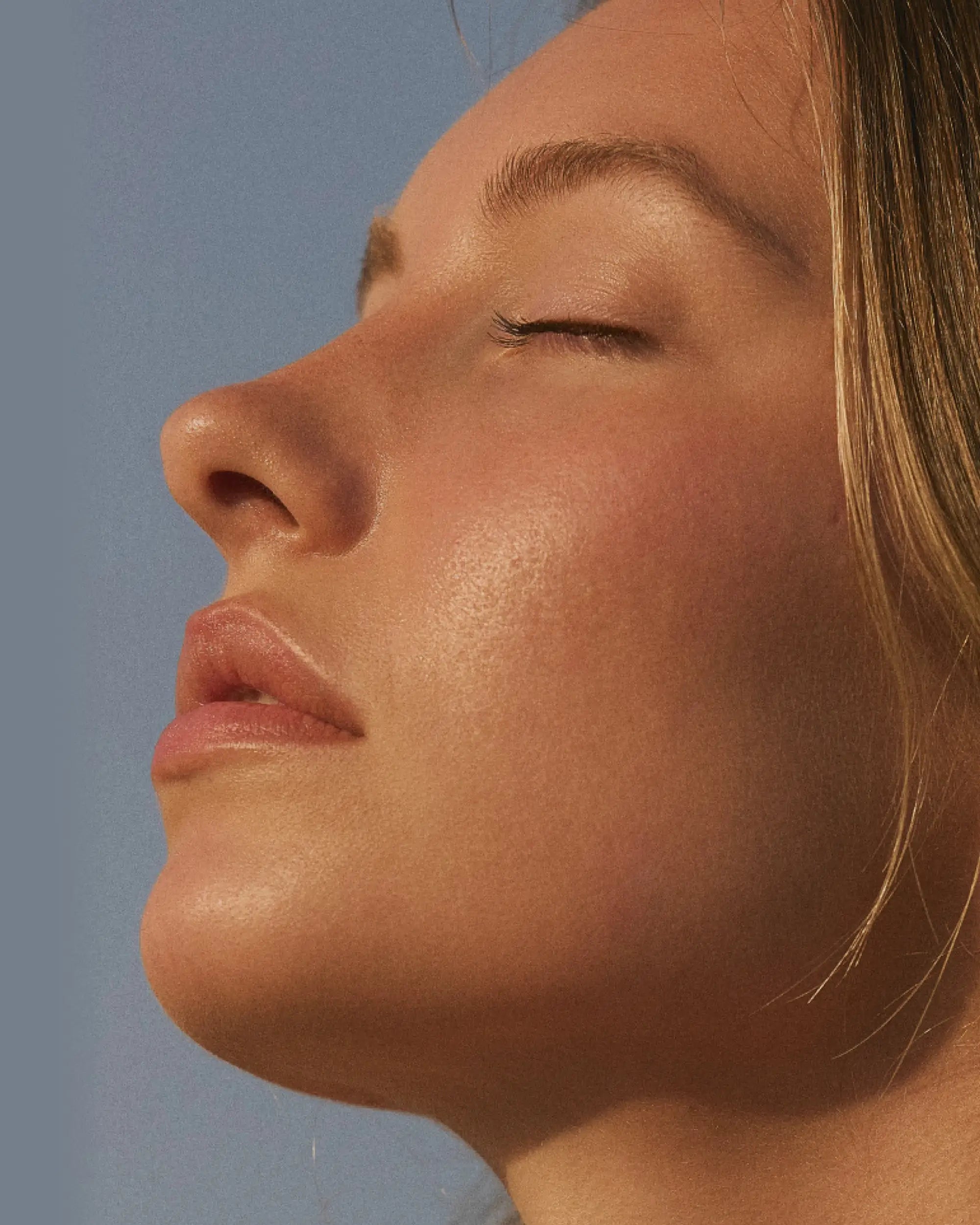 Excel V+ CoolView laser treatment at CQ Aesthetics Rockhampton
