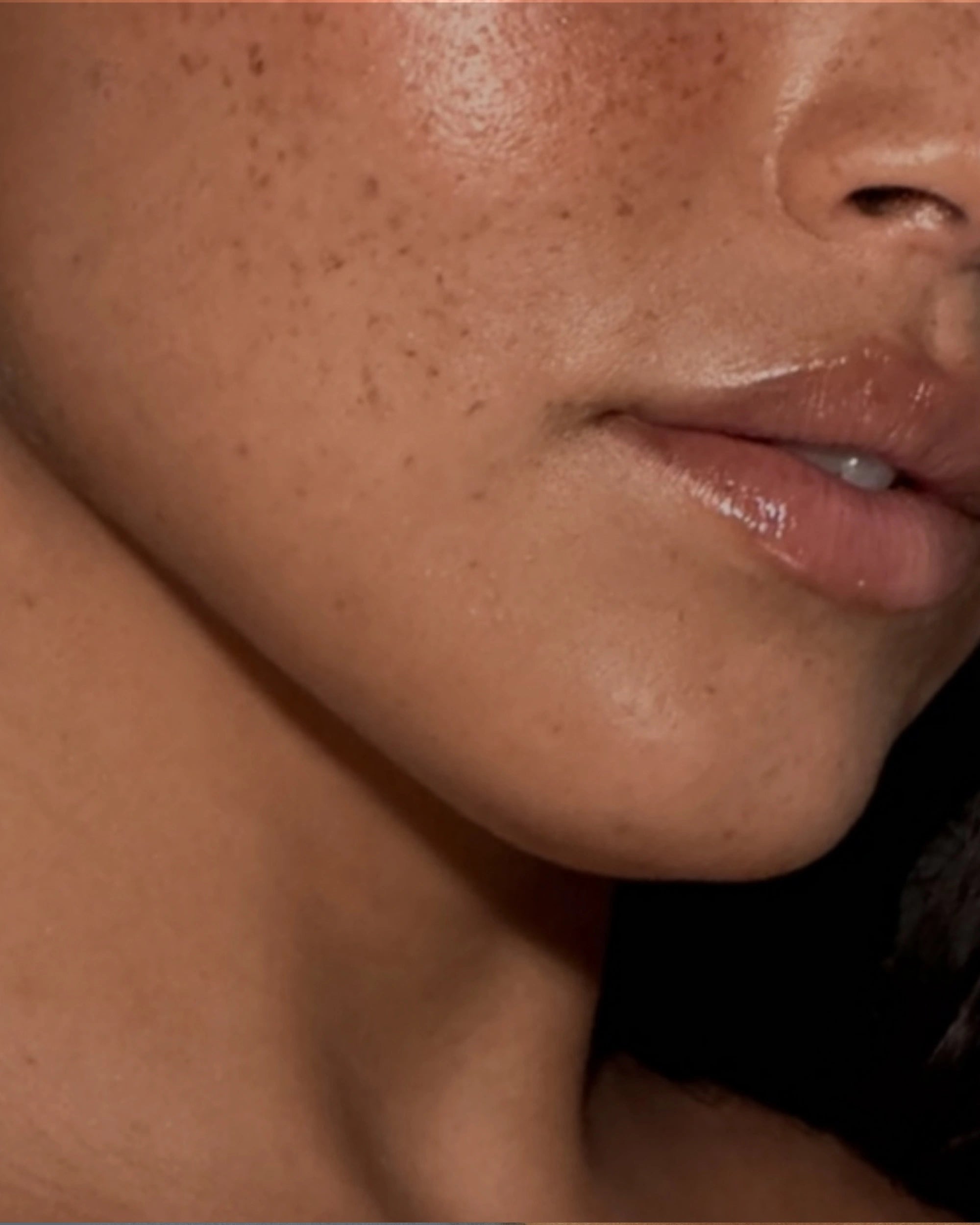 Laser Genesis laser facial treatment at CQ Aesthetics Rockhampton